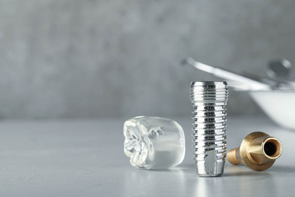 Why Dental Implants Are Good For Your Health