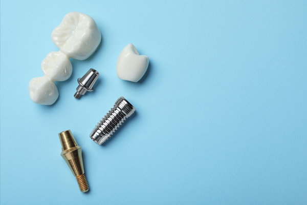 Dental Implants And Osseointegration