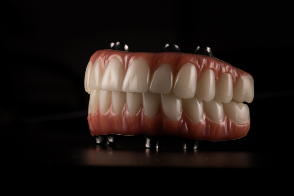 Get A New Smile With Implant Supported Dentures