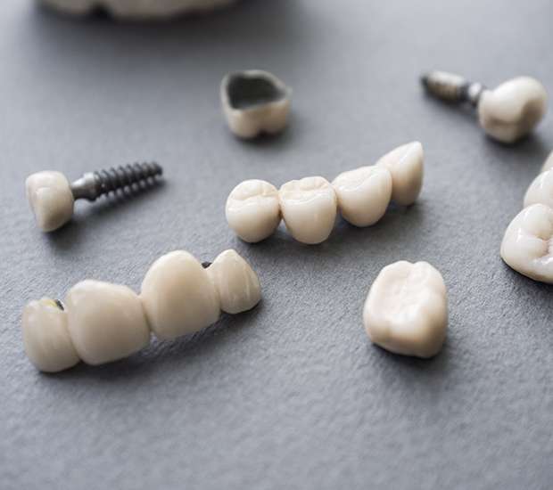 East Point The Difference Between Dental Implants and Mini Dental Implants